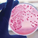 Test de endotoxinas bacterianas